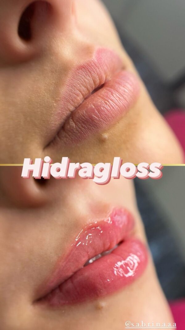Hydragloss resultado